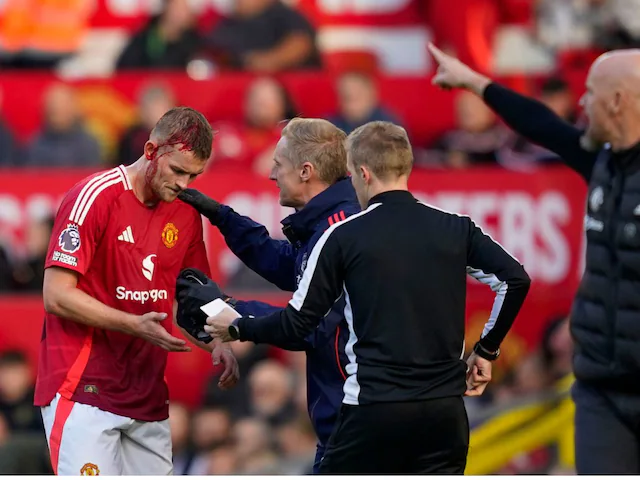 Manchester United Conceded While Temporarily Down to 10 Men after Matthijs de Ligt Sustained Cut on his head